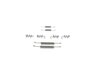 SET ACCESORII SABOTI FRANA BOSCH 1 987 475 366 - Compatibil cu VOLVO