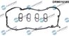 SET GARNITURI CAPAC CULBUTORI DR.MOTOR AUTOMOTIVE DRM01618S - Compatibil cu JAGUAR, LAND ROVER