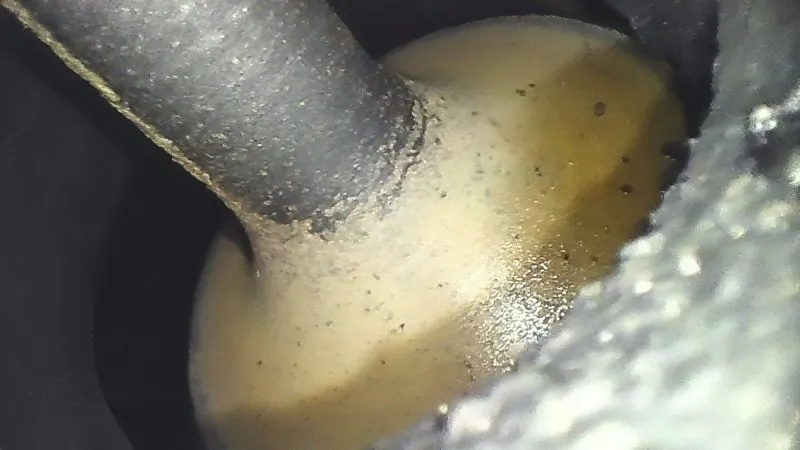 Set video endoscop